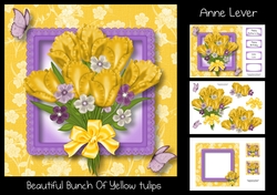 Beautiful Bunch Of Yellow Tulips