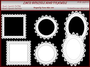 Lace Doilies and Frames Collection