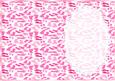 Shades of Pink Footprints Insert, with Lace